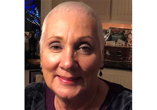 To Dye or Not to Dye – That is the Question